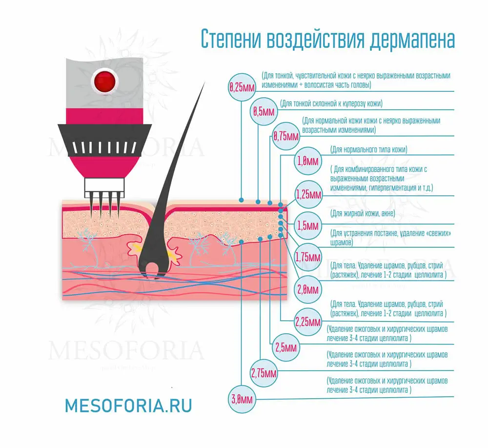 Какие длины игл можно использовать?
