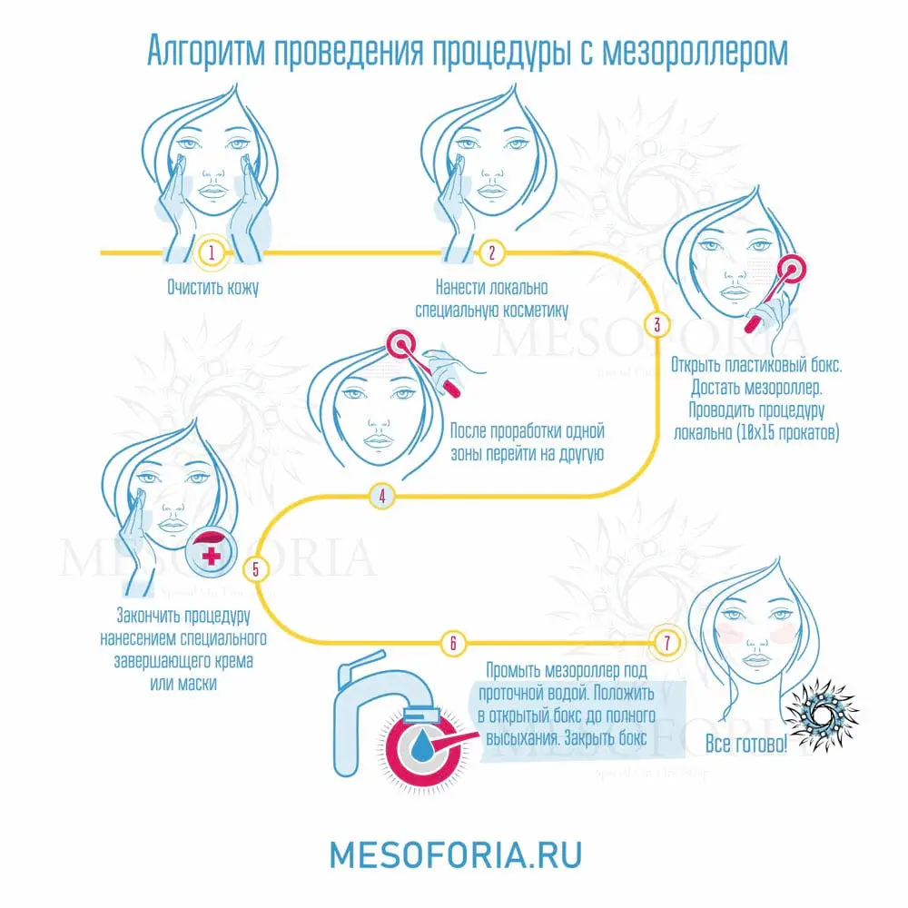 Алгоритм применения мезороллера