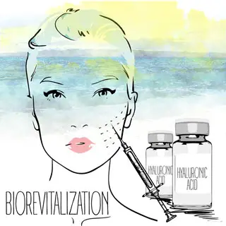 Биоревитализация что это за процедура?