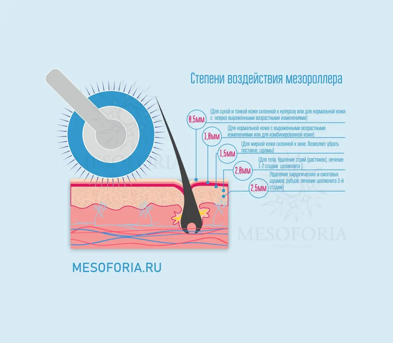 Степени воздействия мезороллер