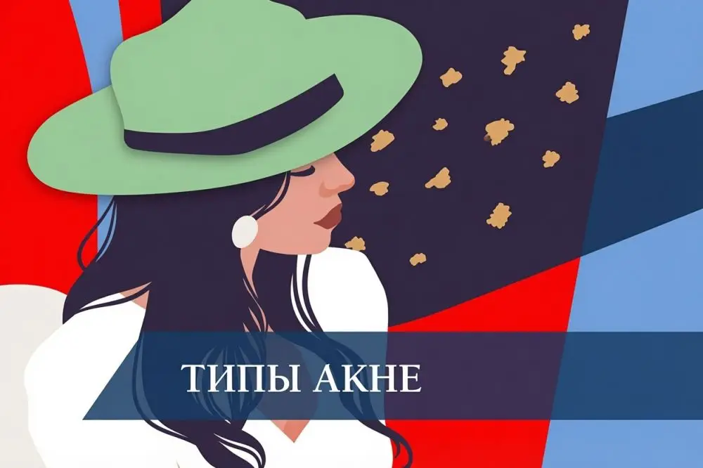 Типы и виды акне: что это такое и как лечить