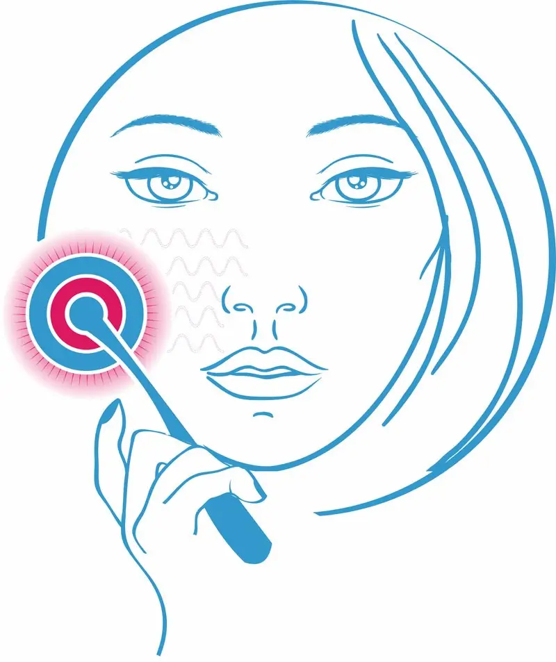 Готовые наборы с мезороллерами