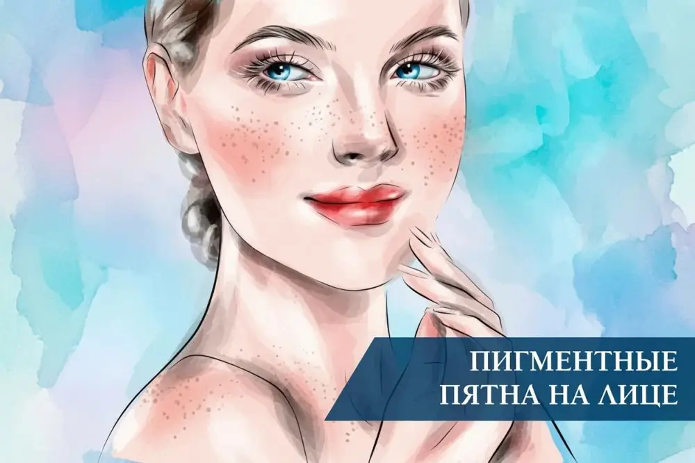 Пигментные пятна на лице: причины появления и способы устранения