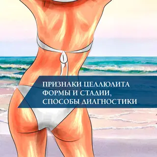 Признаки целлюлита формы и стадии, способы диагностики Признаки целлюлита формы и стадии, способы диагностики