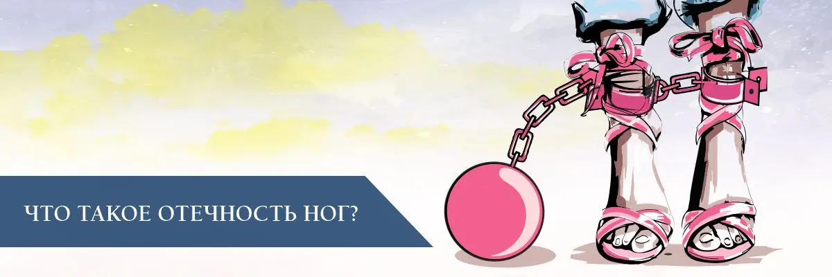 Что такое отечность ног? Что такое отечность ног?