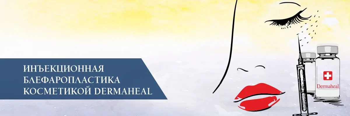 Инъекционная блефаропластика косметикой Dermaheal Инъекционная блефаропластика косметикой Dermaheal