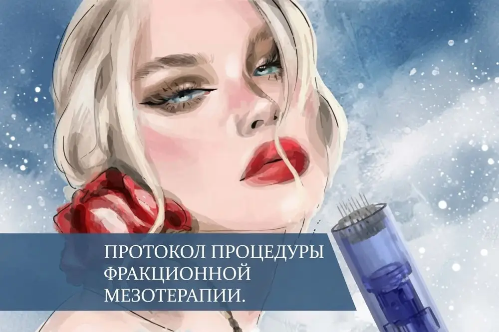 Протокол процедуры фракционной мезотерапии