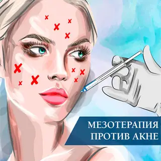 Мезотерапия против акне Мезотерапия против акне