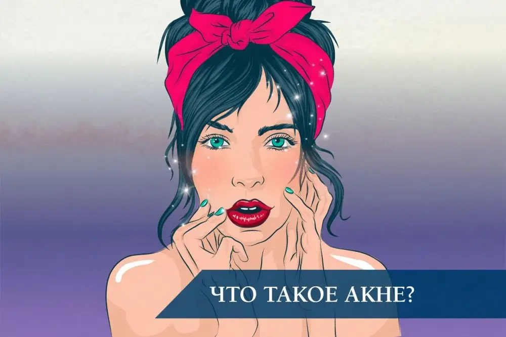 Что такое акне и его основные виды