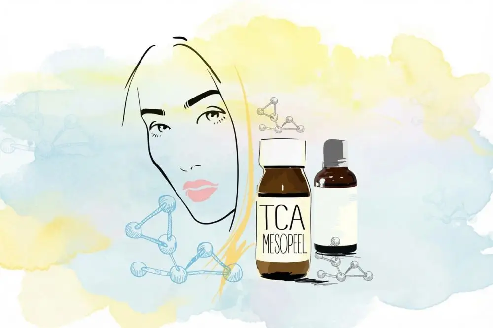 ТСА (трихлоруксусный) пилинг – Что это такое?