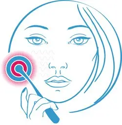 Фотонные мезороллеры