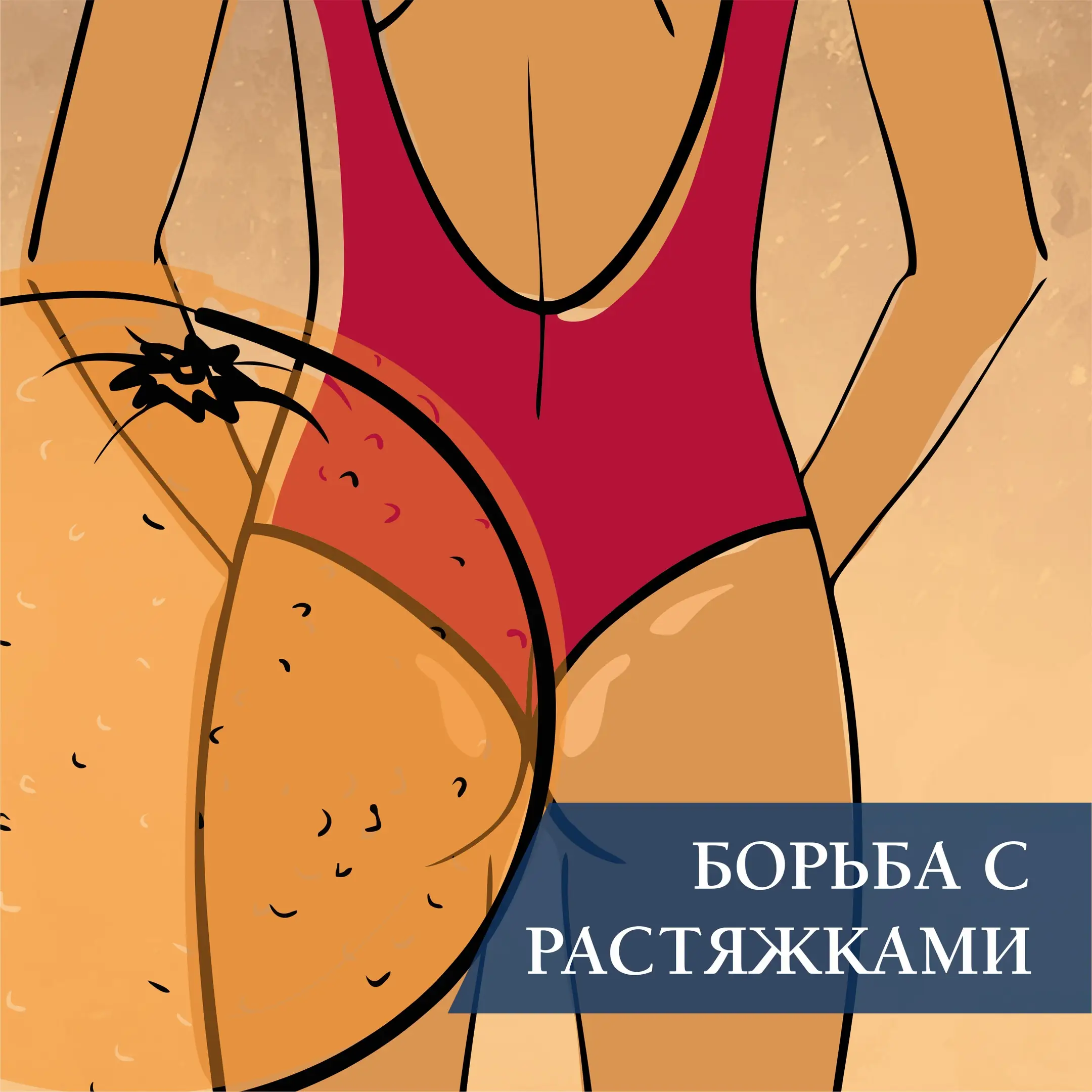 Борьба с растяжками Борьба с растяжками