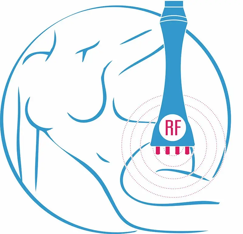 Аппараты для RF-лифтинга